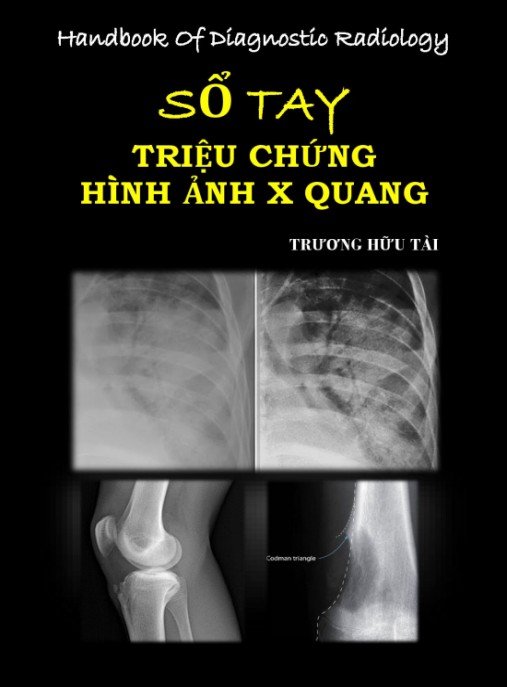 Tài Liệu Số Sổ tay Triệu chứng hình ảnh X-quang
