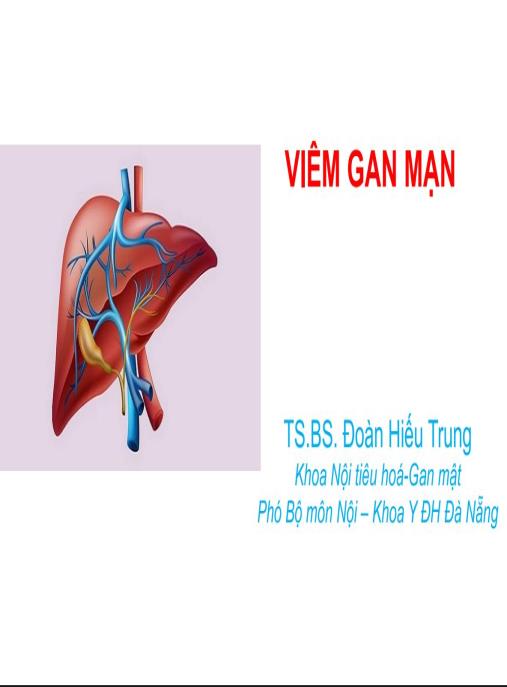 Tài liệu số Bài giảng Viêm gan mạn