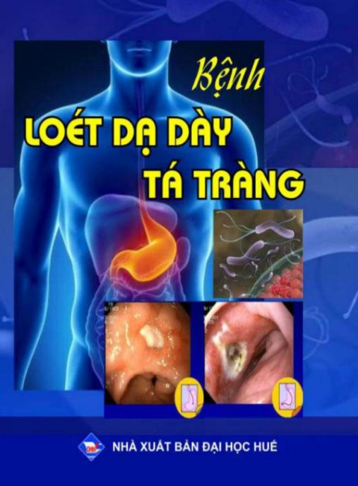Tài liệu số Bện Loét Dạ Dày Tá Tràng