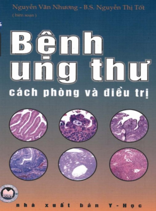 Tài liệu số Bệnh Ung Thư Cách Phòng Và Điều Trị