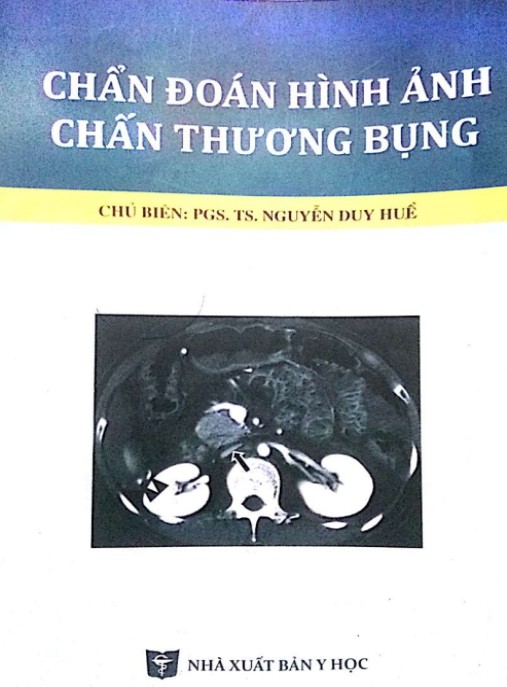 Tài liệu số Chẩn Đoán Hình Ảnh Chấn Thương Bụng