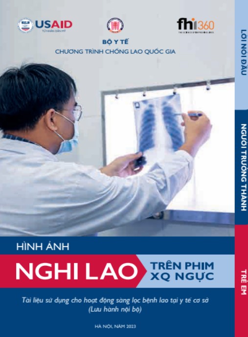 Tài liệu số Hình Ảnh Nghi Lao Trên Phim XQ Ngực