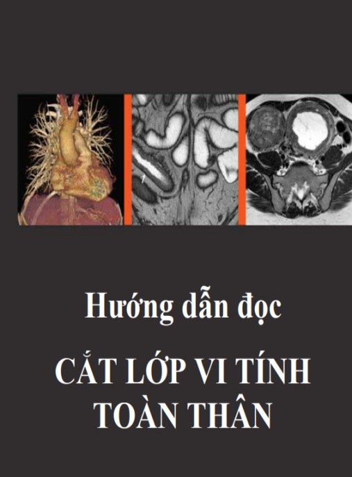 Tài liệu số Hướng Dẫn Đọc Cắt Lớp Vi Tính Toàn Thân