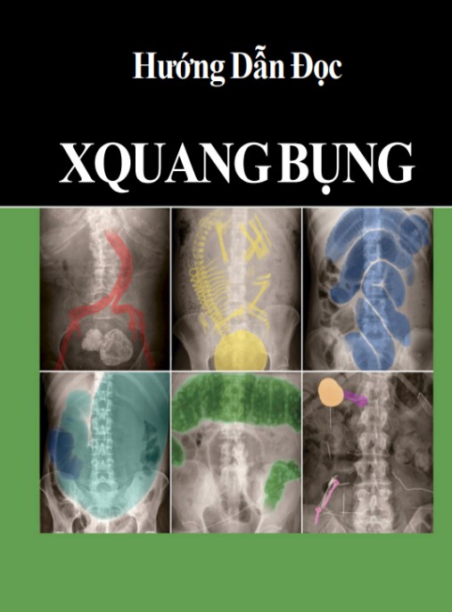 Tài liệu số Hướng Dẫn Đọc X Quang Bụng