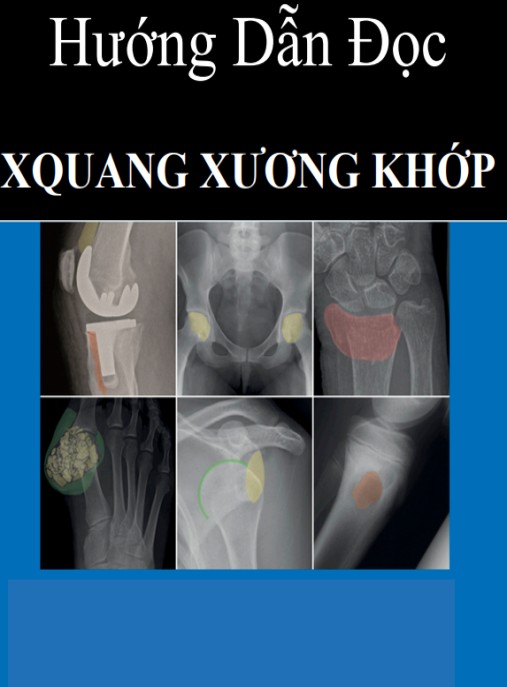 Tài liệu số Hướng Dẫn Đọc X Quang Xương Khớp