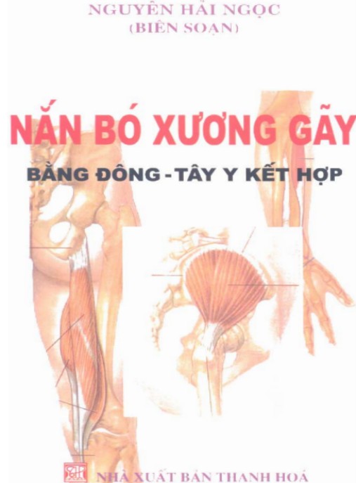 Tài liệu số Nắn Bó Xương Gãy Bằng Đông-Tây Y Kết Hợp